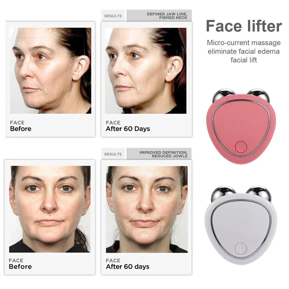 LuméLift™ – Advanced Face Lifting & Sculpting Device
